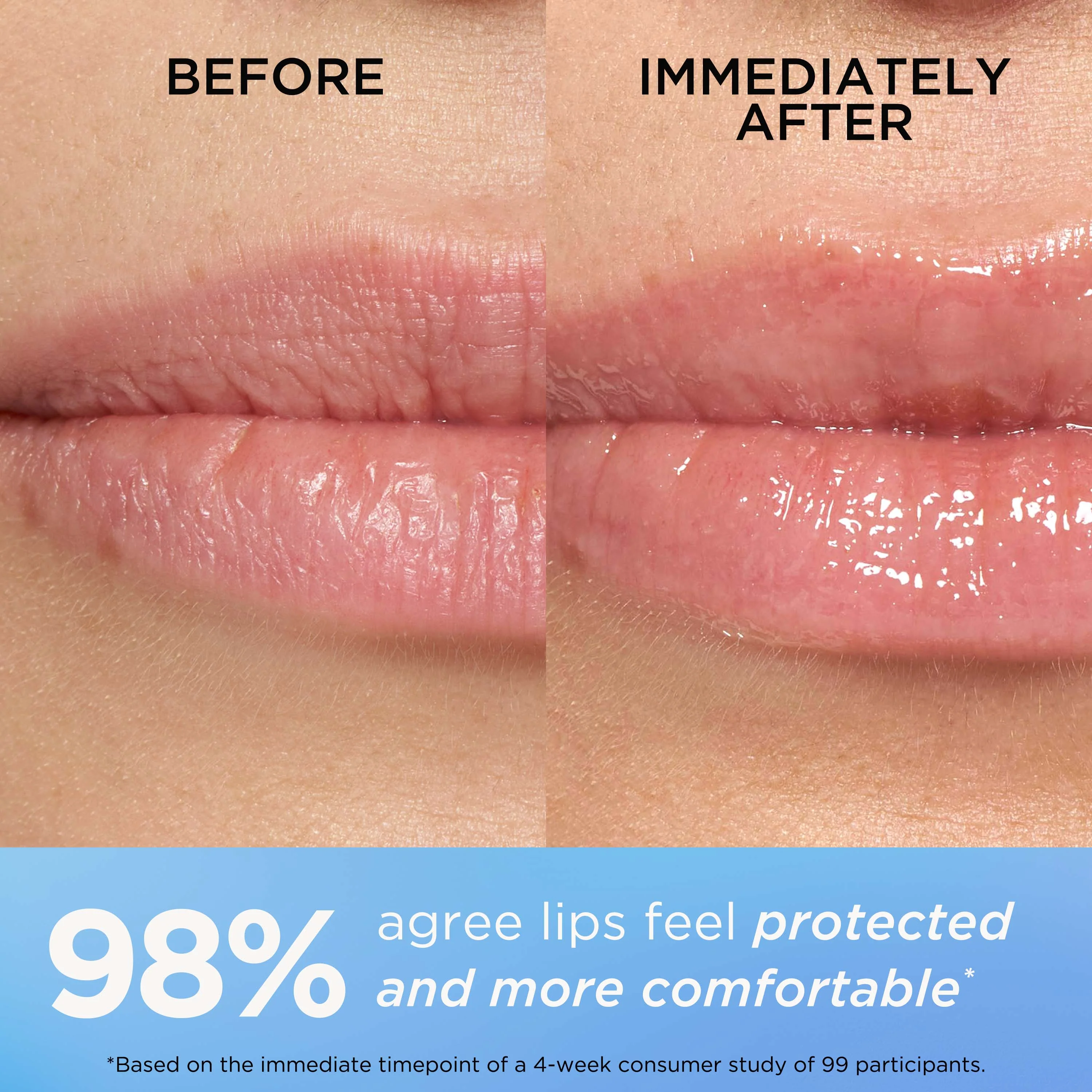 Eight Hour Cream Intensive Lip Repair Balm - Image 11