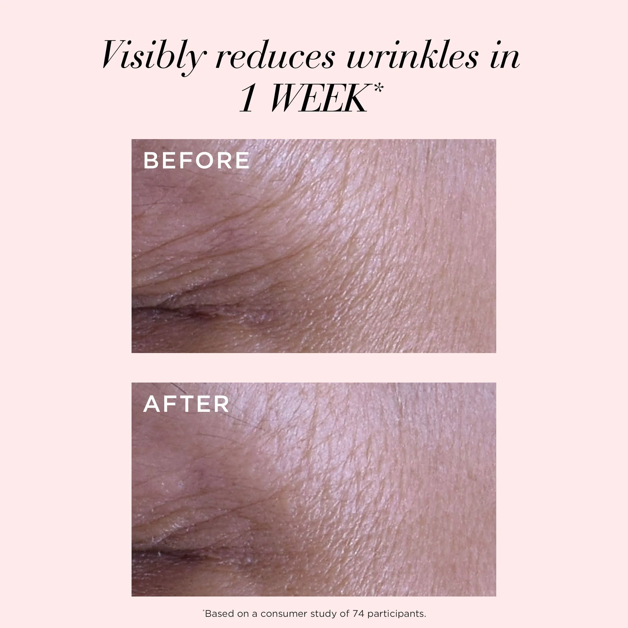 Retinol + HPR Ceramide Rapid Skin-Renewing Water Cream - Image 6