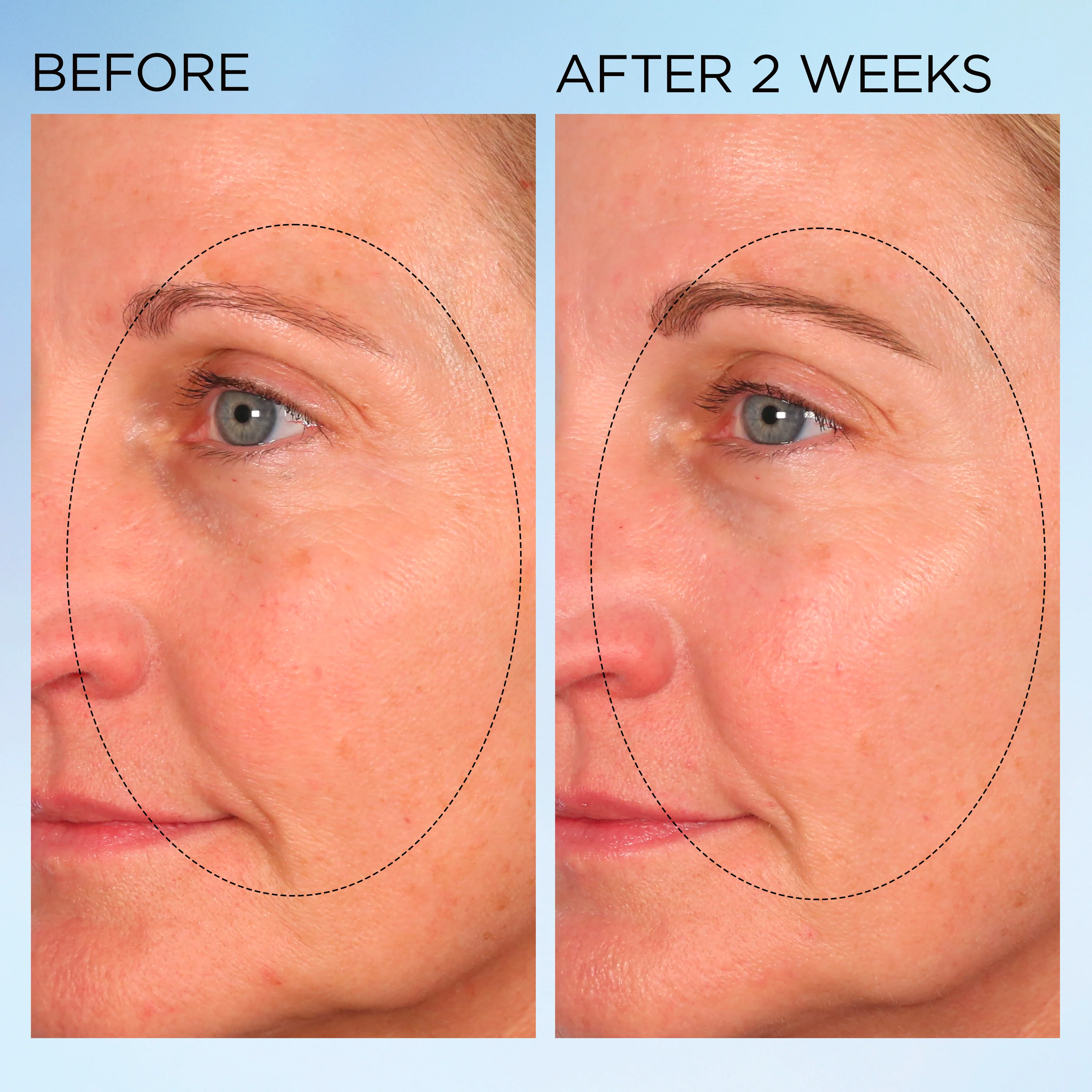 Visible Brightening Clearly Radiant Spot Correcting Capsules - Image 10