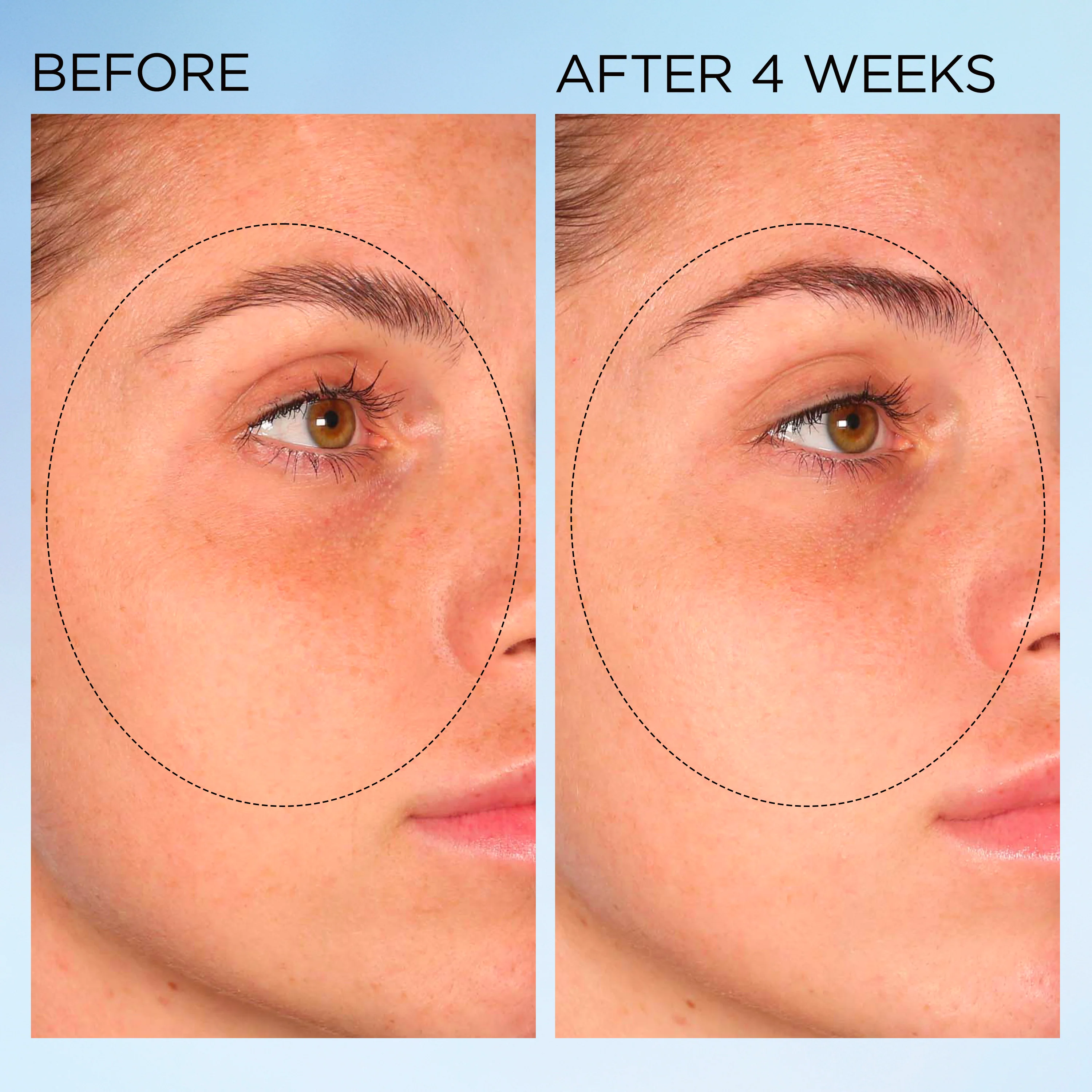 Visible Brightening Clearly Radiant Spot Correcting Capsules - Image 11